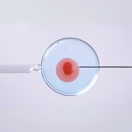 Sperm Injection
