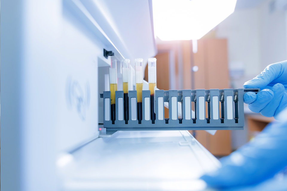 Diagnostic Tests