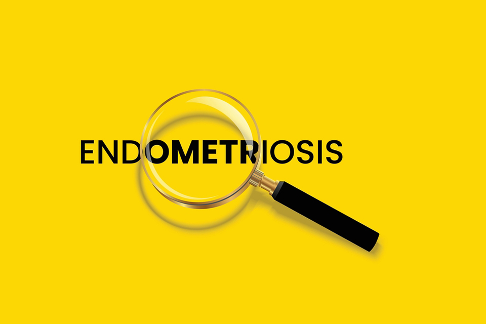 Endometriosis