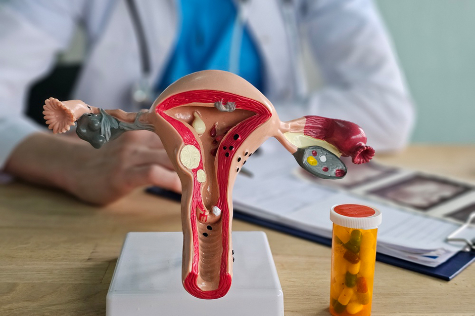 Fallopian Tubes