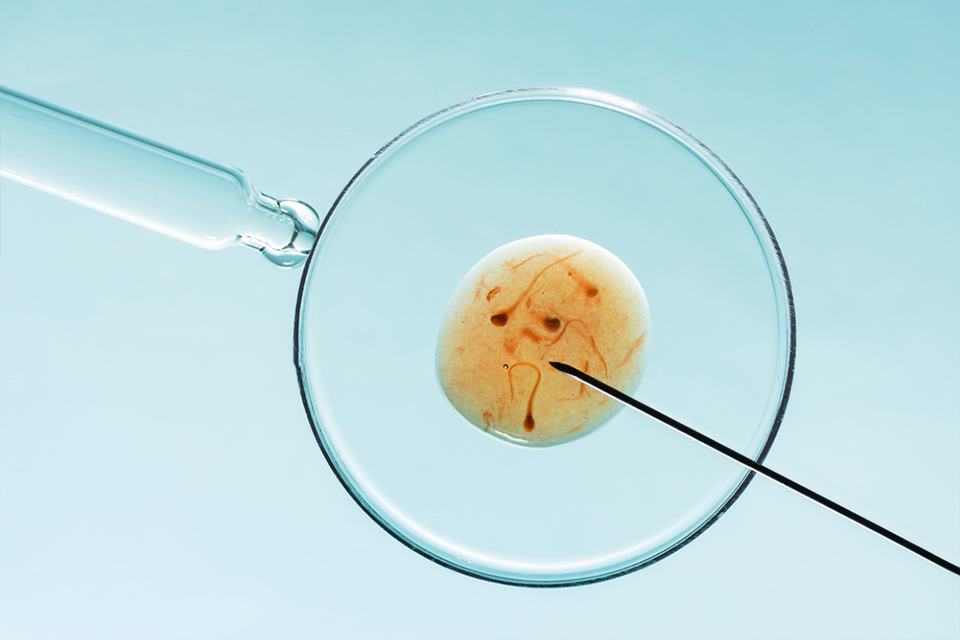 IVF